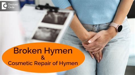 Hymens can come in different shapes. . Broken hymen appearance